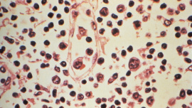 AFP__20260506__A9ZA6CU__v1__MidRes__UsHealthHantavirus.jpg