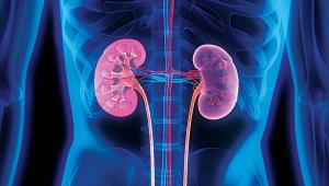 chronic-kidney-disease.jpg
