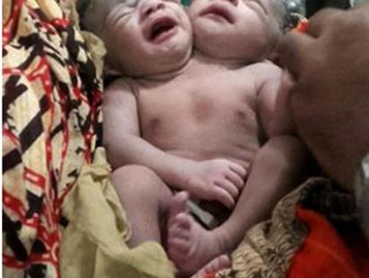 two-headed-baby-web.jpg