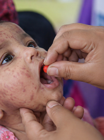 measles-vitamin-a.jpg